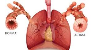 Психосоматика Бронхиальная астма