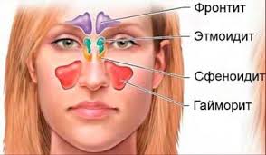Психосоматика сфеноидита