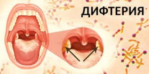 Психосоматика Дифтерия