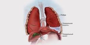 Психосоматика гидроторакса