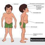 Психосоматика – Мукополисахаридоза