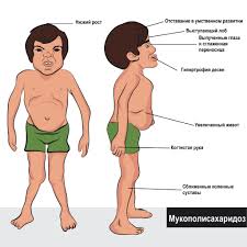Психосоматика – Мукополисахаридоза