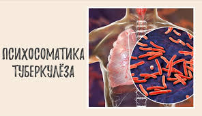 Психосоматика – Туберкулёза